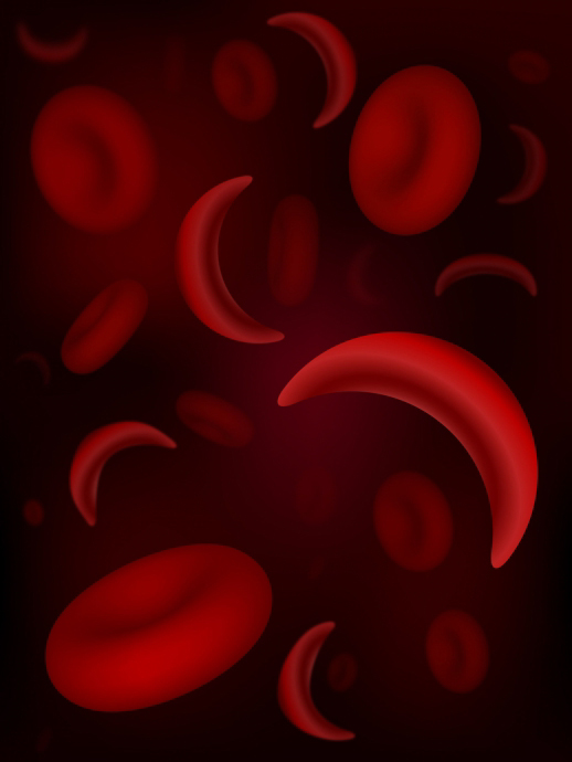 sickle_cellpic